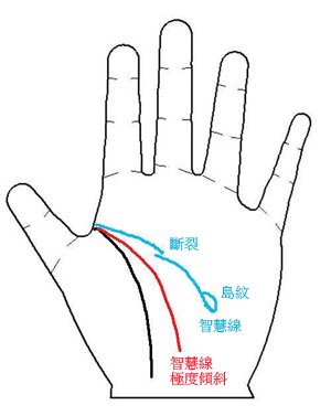 手相图解,手相算命图解,手相看病