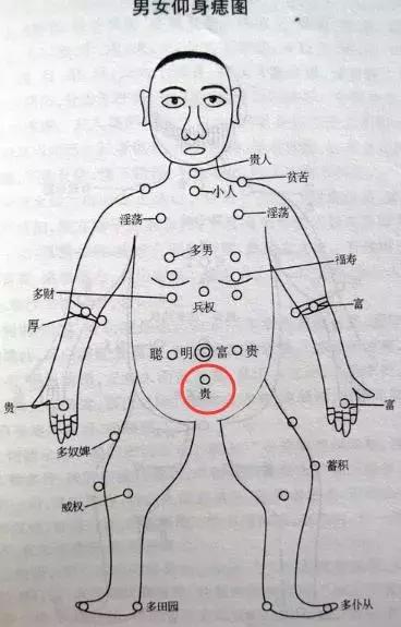 你身上有「发财痣」吗