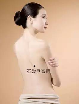 女人身上的8种福痣5种祸痣