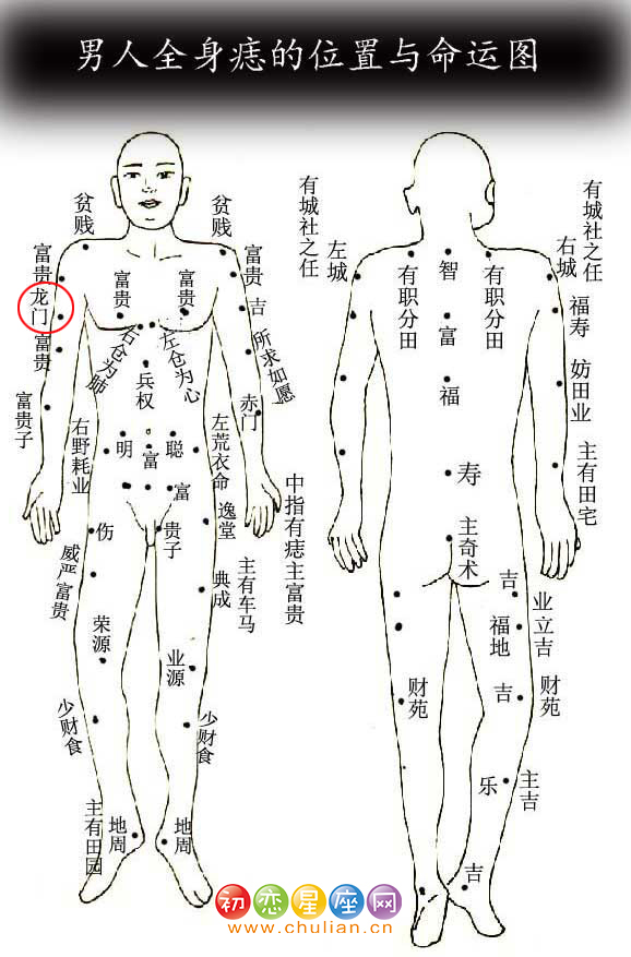 龙门痣