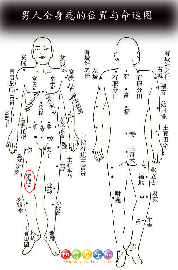 荣源痣