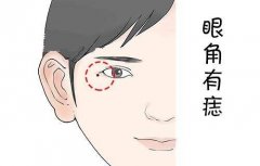 男人左眼角有痣好不好