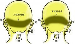 10.两弦明月骨