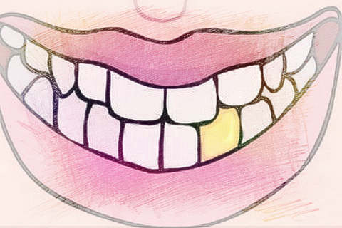 梦见牙齿变黄　周公解梦之梦到牙齿变黄